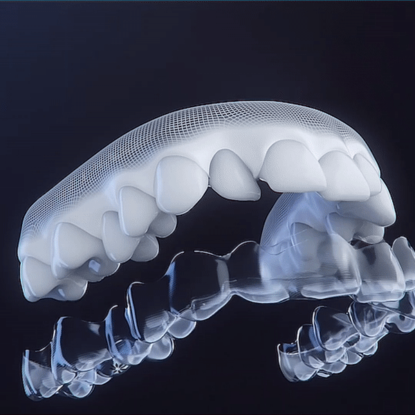 Clear Aligners Treatment